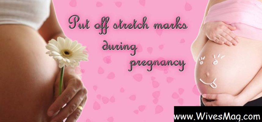 stretch marks during pregnancy