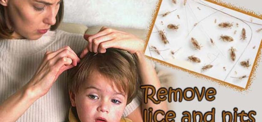 Remove lice and nits