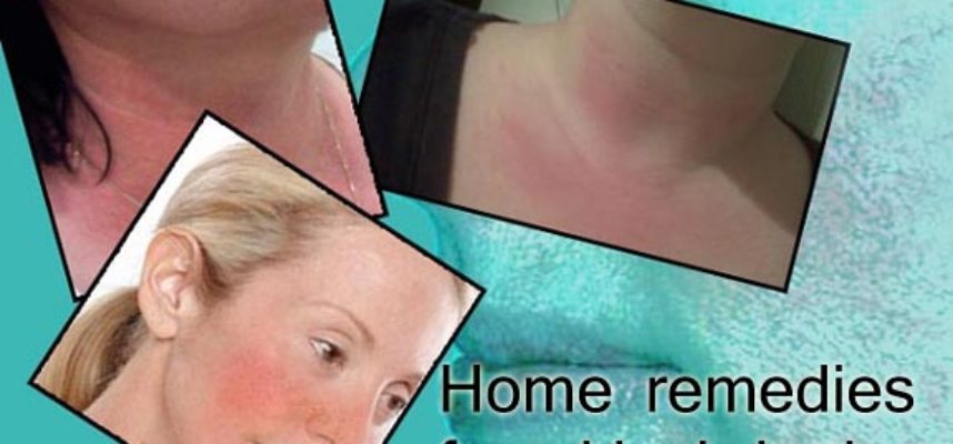 home remedies for skin irritation