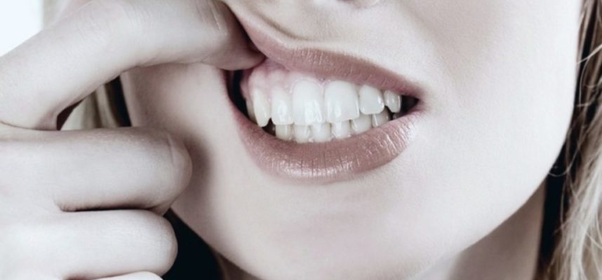 Gum Disease And How It Comes About