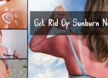 get-rid-of-sunburn-naturally