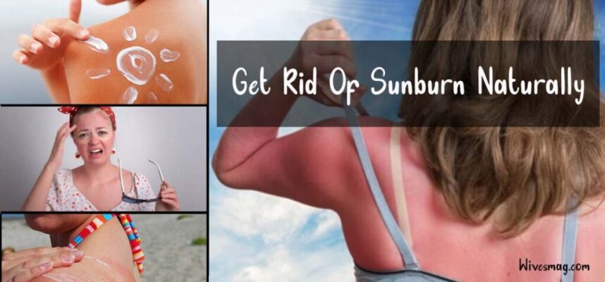 get-rid-of-sunburn-naturally